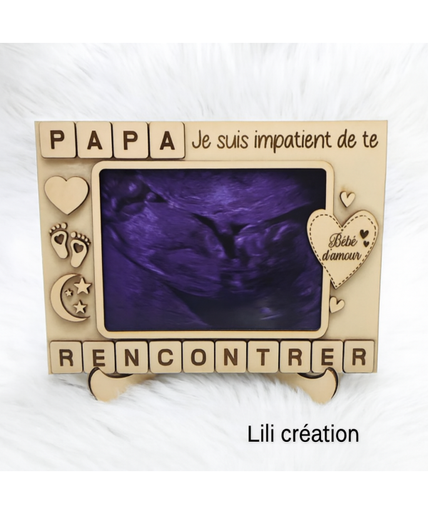 Cadre échographique personnalisé – annonce pleine d’émotion