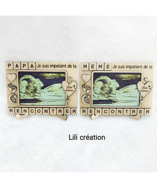 Cadre échographique personnalisé – annonce pleine d’émotion